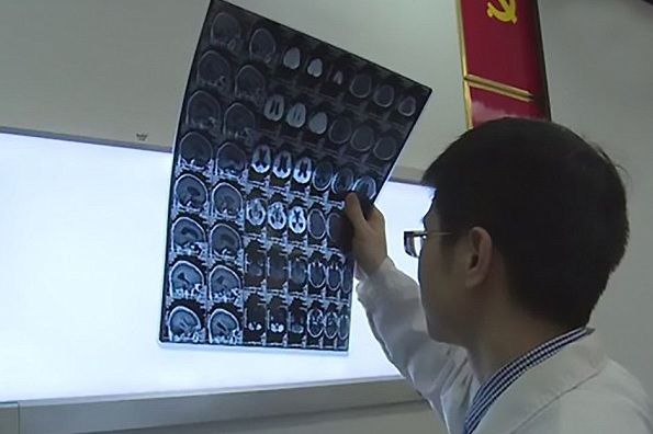 生肉食べた中国人男性の脳から寄生虫30匹（海外の反応）