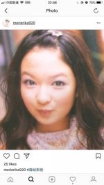 中国人「日本の整形技術はとても自然で素晴らしいですね」　中国の反応