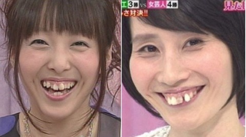今、日本で流行している「八重歯整形」…専門家「日本は不完全を好むので歯をねじって八重歯にする」
