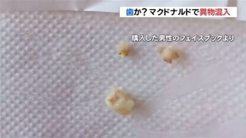 日本のマクドナルドで商品から歯のような異物（海外の反応）