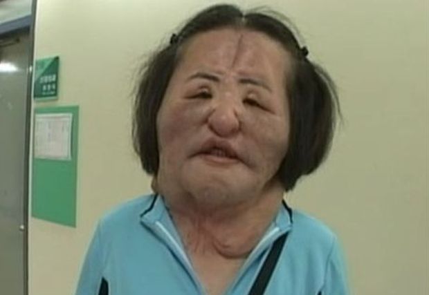 韓国人「死去した扇風機おばさんの整形前の写真を見てみよう」