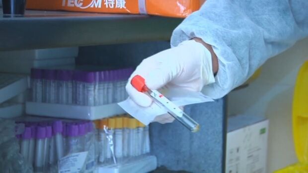 中国・英国メディア「新型コロナウイルス、水産市場ではなく実験室から流出の可能性」＝韓国の反応